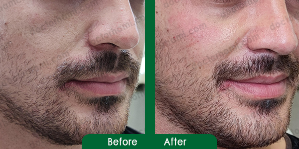 ژل گونه یزد