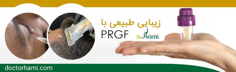 زیبایی طبیعی با PRGF