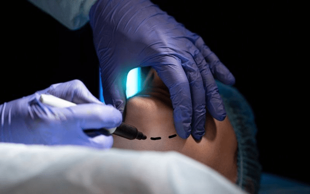 بررسی سریع‌ترین راه‌های رفع غبغب (روش‌های پزشکی و کلینیکی)