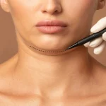 بررسی بهترین دستگاه رفع غبغب 2025