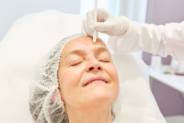 معرفی و مقایسه بهترین برندهای فیلر لیفت صورت 