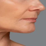 بهترین پزشک برای برداشتن غبغب