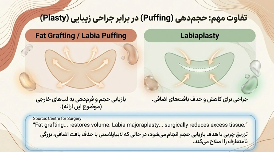 تفاوت تزریق ژل و چربی به واژن