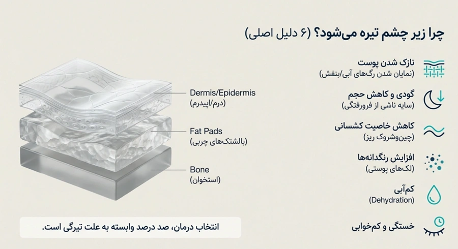 دلیل تیرگی زیر چشم