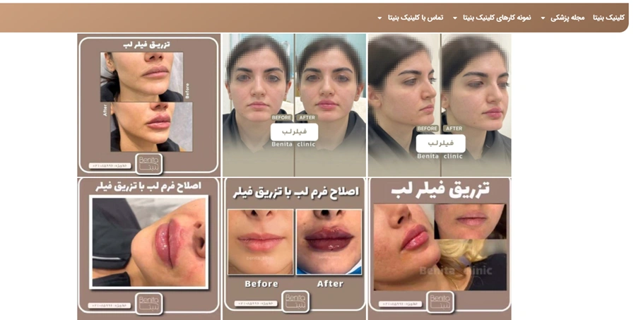 کلینیک زیبایی بنیتا