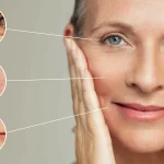 بهترین جراح لیفت صورت در یزد