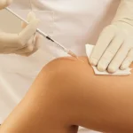 تزریق فیلر بادی در تهران