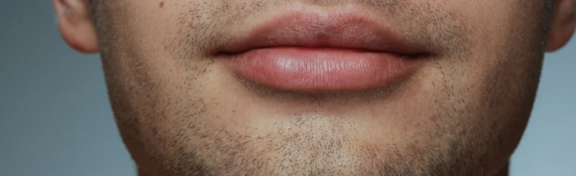 اصلاح فرم لب مردانه