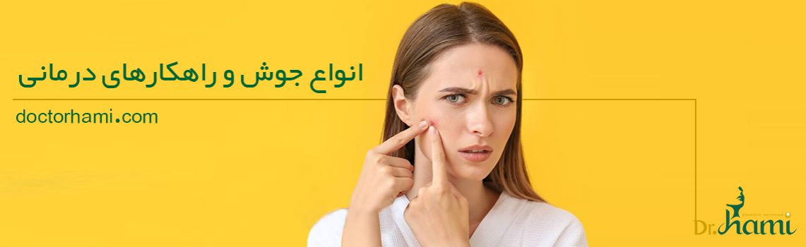 docotorhami article-types of acne 2