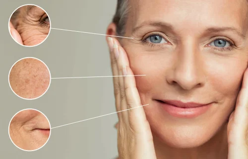 بهترین جراح لیفت صورت در یزد