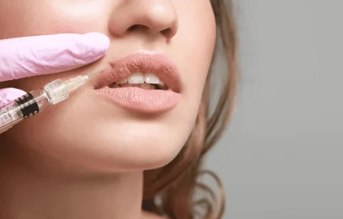 بهترین دکتر تزریق ژل لب در یزد