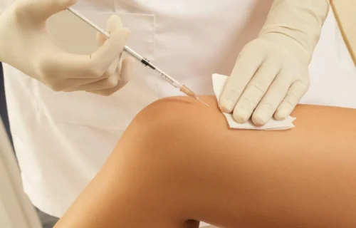 تزریق فیلر بادی در تهران